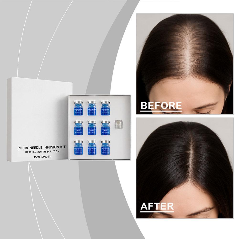 Kit de Rolo de Microagulhas co - Hair Care Oil Serum avaliação e preço