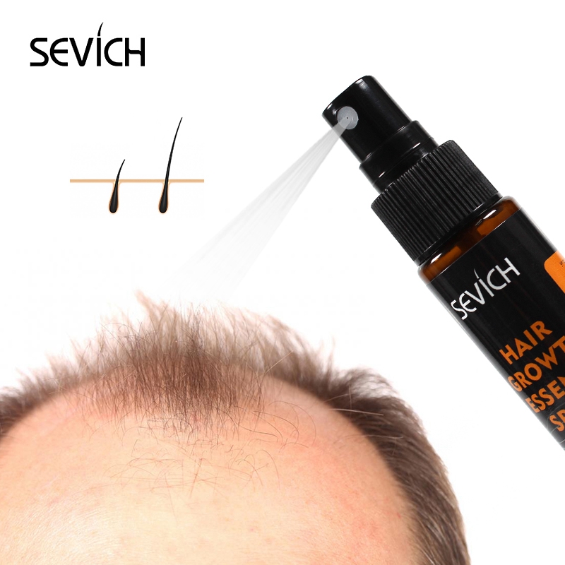Sevich-Spray rápido do crescim - Hair Care Fragrance Essential Oil avaliação e preço